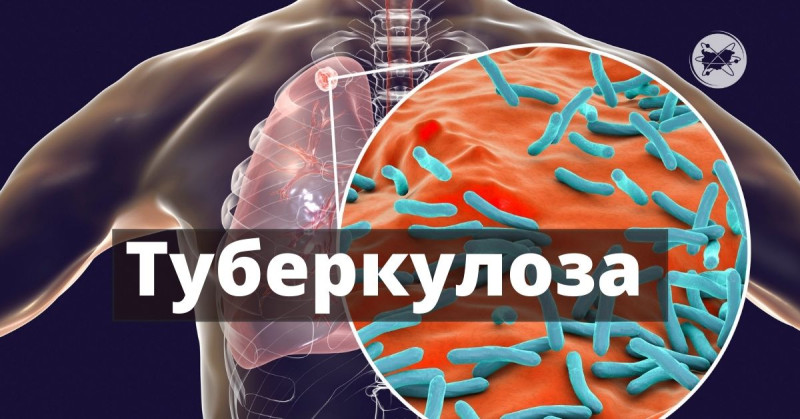 Снимка за Седмица на отворените врати за ранно откриване ...